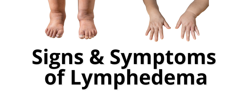 signs and symptoms of lymphedema